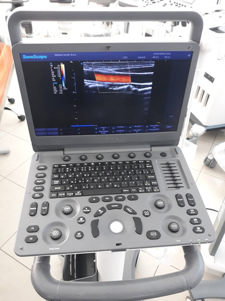 E2 carotid