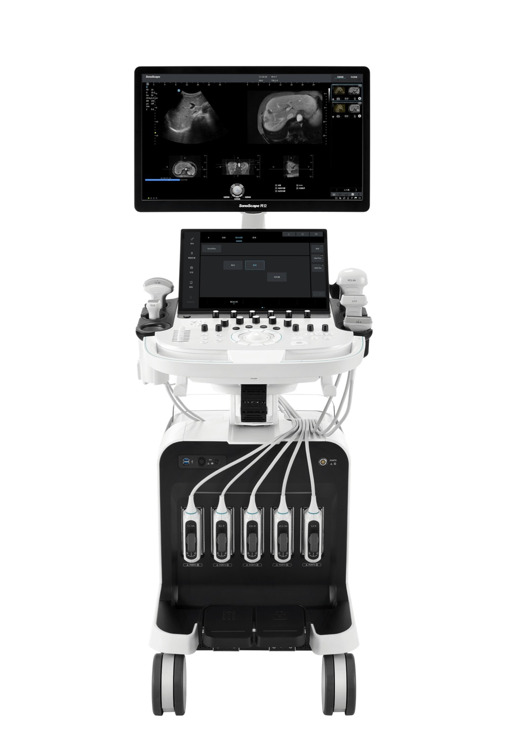 Ultrazvuk SonoScape S80 – novi model